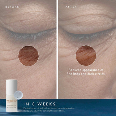 Daily Vitamin C Eye Serum